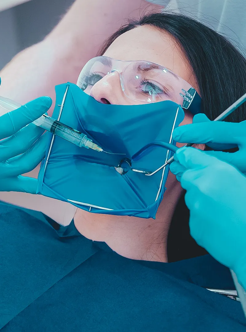 Trattamento endodontico con diga di gomma